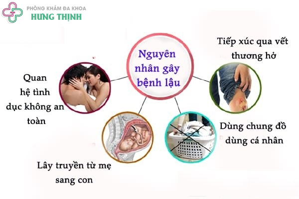 Bệnh lậu và những điều không phải ai cũng biết